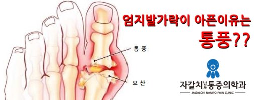 발가락이아파요1
