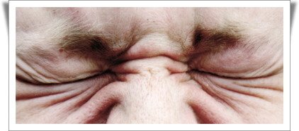 머리카락이식수술4