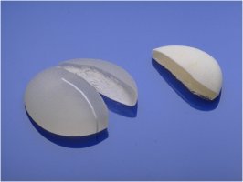 가슴성형잘하는곳1