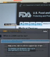 라식라섹부작용5