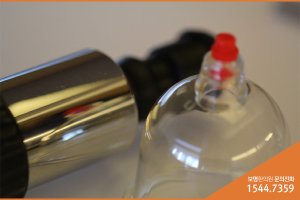 사마귀냉동치료1