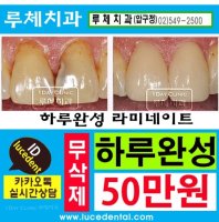 라미네이트연예인2