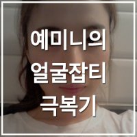 제미니레이저2