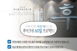 여드름피부과비용1