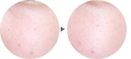 지성수분크림추천2