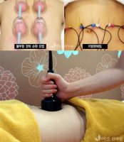 다이어트클리닉1