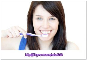 부정교합턱교정5