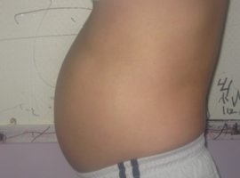 부산메조테라피1