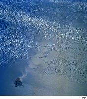 배지방흡입수술4