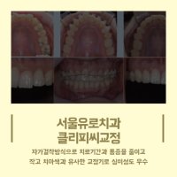 신사역치아교정1