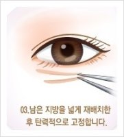 다크써클잘하는곳4