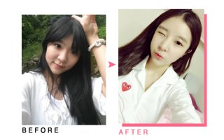 귀뒤사각턱병원2