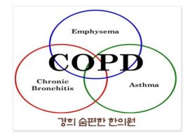 COPD2