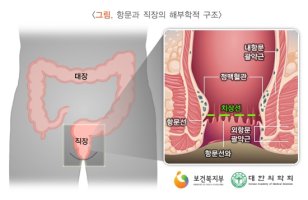 대장항문과1