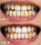 블랑시크릿미백치약1