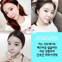 귀뒤사각턱병원3