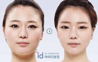 귀뒤사각턱병원5