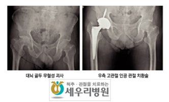대전관절병원1