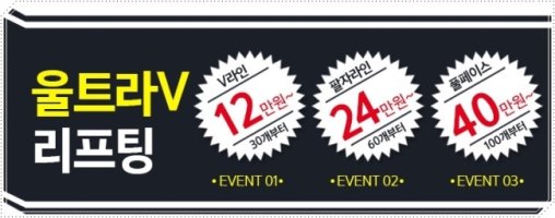 얼굴리프팅가격1