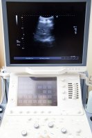 복부초음파4