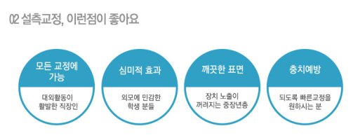 을지로치아교정2