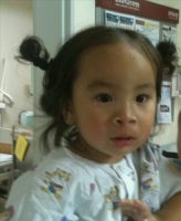 구순구개열수술1