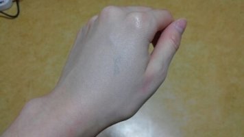 엔프라니비비크림5