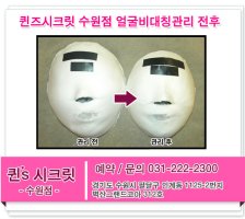 수원얼굴축소5