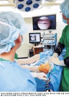 줄기세포연골재생술4