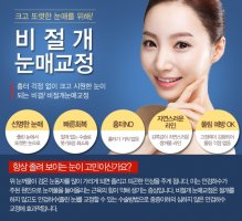 압구정눈성형2