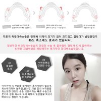 귀뒤사각턱병원4